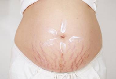 Làm thế nào để ngăn ngừa tình trạng nám, sạm da khi mang thai?